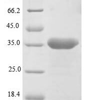 Macaca fascicularis Legumain (LGMN) Recombinant Protein - BioCrest Sci