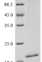Human Sal-like protein 4 (SALL4), partial Recombinant Protein, N-10His, aa 954–1053+11R - BioCrest Sci