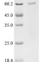 Human TNF receptor-associated factor 3 (TRAF3) Recombinant Protein, C-His - BioCrest Sci