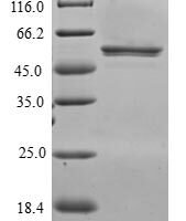 Human CXXC-type zinc finger protein 4 (CXXC4) Recombinant Protein - BioCrest Sci