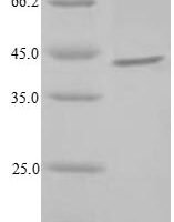 Escherichia coli Dephospho-CoA kinase (coaE) Recombinant Protein - BioCrest Sci