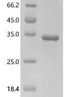 Human Mucin-2 (MUC2),partial Recombinant Protein - BioCrest Sci