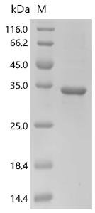Human Mucin-2 (MUC2),partial Recombinant Protein, Homo sapiens (Human), E.coli, C-terminal 6xHis-tagged, 29.8 kDa, purity >≥ 90% as determined by SDS-PAGE.