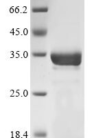 Escherichia coli Pimelyl-[acyl-carrier protein] methyl ester esterase (bioH) Recombinant Protein - BioCrest Sci
