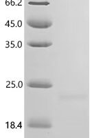 Mouse Hepcidin (Hamp), partial Recombinant Protein - BioCrest Sci