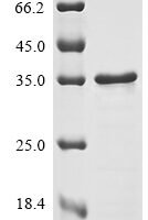 Dengue virus type 2 Genome polyprotein (Q1642N), partial Recombinant Protein - BioCrest Sci