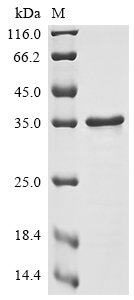 Dengue virus type 2 Genome polyprotein (Q1642N), partial Recombinant Protein, Dengue virus type 2, E.coli, N-terminal 6xHis-tagged, 28.8 kDa, purity >≥ 85% as determined by SDS-PAGE.