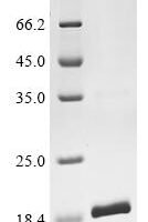 Mouse Angiogenin (Ang) Recombinant Protein - BioCrest Sci