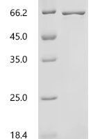 Human L-amino-acid oxidase (IL4I1), partial Recombinant Protein, N-His/C-His - BioCrest Sci