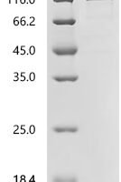 Pig Glutamate carboxypeptidase 2 (FOLH1), partial Recombinant Protein - BioCrest Sci