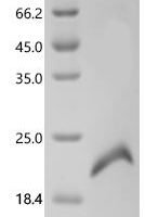 Rat Glycoprotein hormones alpha chain (Cga) Recombinant Protein - BioCrest Sci