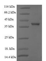 Human G1/S-specific cyclin-D1 (CCND1) Recombinant Protein - BioCrest Sci