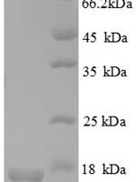 Human CDKN2AIP N-terminal-like protein (CDKN2AIPNL) Recombinant Protein - BioCrest Sci