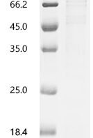Mouse Cadherin-16 (Cdh16), partial Recombinant Protein, C-His - BioCrest Sci