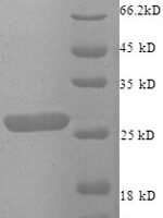 Human Zinc finger matrin-type protein 2 (ZMAT2), partial Recombinant Protein - BioCrest Sci