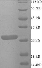Human Zinc finger matrin-type protein 2 (ZMAT2), partial Recombinant Protein, Homo sapiens (Human), E.coli, N-terminal 6xHis-tagged, 27.0 kDa, purity >≥ 90% as determined by SDS-PAGE.