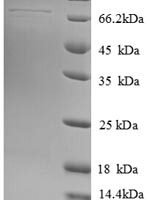 Human Heat shock 70 kDa protein 13 (HSPA13) Recombinant Protein - BioCrest Sci
