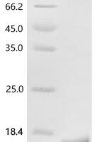 Human Tumor necrosis factor alpha-induced protein 2 (TNFAIP2), partial Recombinant Protein, N-10His/C-Myc - BioCrest Sci