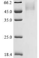 Human Protein Wnt-8a (WNT8A) Recombinant Protein, C-10His - BioCrest Sci