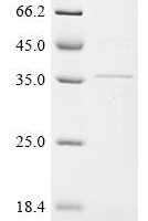 Rat Troponin T, cardiac muscle (Tnnt2) Recombinant Protein, Tag-Free - BioCrest Sci