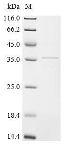Rat Troponin T, cardiac muscle (Tnnt2) Recombinant Protein, Tag-Free, Rattus norvegicus (Rat), E.coli, Tag-Free, 35.7 kDa, purity >≥ 85% as determined by SDS-PAGE.