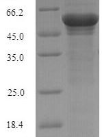 Schizosaccharomyces pombe NADH kinase pos5, mitochondrial (pos5) Recombinant Protein, N-His-SUMO - BioCrest Sci