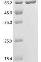 Escherichia coli Low molecular weight protein-tyrosine-phosphatase Wzb (wzb), Biotinylated Recombinant Protein - BioCrest Sci