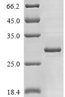 Mouse Fibroblast growth factor 20 (Fgf20) Recombinant Protein, N-His - BioCrest Sci