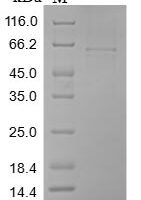 Human Cartilage intermediate layer protein 1 (CILP), partial Recombinant Protein, N-10His/C-Myc - BioCrest Sci