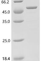 Human Protein NDRG1 (NDRG1)(S336D,T346D) Recombinant Protein, C-His - BioCrest Sci