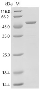 Human Protein NDRG1 (NDRG1)(S336D,T346D) Recombinant Protein, C-His, E.coli, C-terminal 6xHis-tagged, 49.7 kDa, purity >≥ 85% as determined by SDS-PAGE.