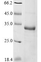 Human Ras-related protein Rab-33B (RAB33B) Recombinant Protein - BioCrest Sci