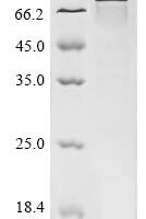 Human Pescadillo homolog (PES1) Recombinant Protein - BioCrest Sci