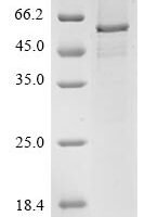 Human Transcriptional enhancer factor TEF-1 (TEAD1) Recombinant Protein, N-His-Avi - BioCrest Sci