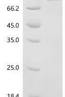 Mouse Receptor-interacting serine/threonine-protein kinase 1 (Ripk1) Recombinant Protein, C-His - BioCrest Sci