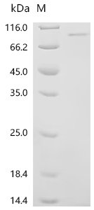 Mouse Receptor-interacting serine/threonine-protein kinase 1 (Ripk1) Recombinant Protein, C-His, Mus musculus (Mouse), E.coli, C-terminal 6xHis-tagged, 81.8 kDa, purity >≥ 85% as determined by SDS-PAGE.