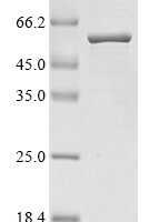 Lactobacillus acidophilus S-layer protein (slpA) Recombinant Protein - BioCrest Sci
