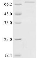 Human YTH domain-containing family protein 2 (YTHDF2) Recombinant Protein - BioCrest Sci