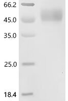 Human B-lymphocyte antigen CD19 (CD19), partial Recombinant Protein - BioCrest Sci