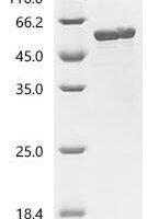 Coxiella burnetii Uncharacterized protein Recombinant Protein, C-His - BioCrest Sci