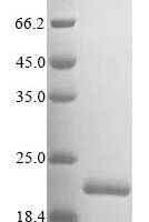 Human E3 ubiquitin-protein ligase ZNRF3 (ZNRF3), partial Recombinant Protein - BioCrest Sci