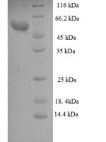 Human Zona pellucida sperm-binding protein 3 (ZP3), partial Recombinant Protein, N-GST - BioCrest Sci