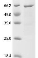 Taxus cuspidata Tubulin beta chain Recombinant Protein - BioCrest Sci