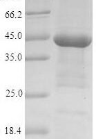 Human Acetylcholine receptor subunit alpha (CHRNA1), partial Recombinant Protein, N-His-Trx - BioCrest Sci