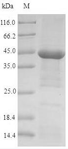 Human Acetylcholine receptor subunit alpha (CHRNA1), partial Recombinant Protein, N-His-Trx, Homo sapiens (Human), E.coli, N-terminal 6xHis-Trx-tagged, 44.1 kDa, purity >≥ 90% as determined by SDS-PAGE.