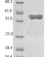 Human Glutamyl-tRNA (Gln) amidotransferase subunit C, mitochondrial (GATC) Recombinant Protein - BioCrest Sci