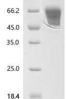 Mouse Muscle, skeletal receptor tyrosine-protein kinase (Musk), partial Recombinant Protein, C-10His - BioCrest Sci