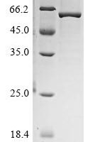 Human Noggin (NOG) Recombinant Protein - BioCrest Sci