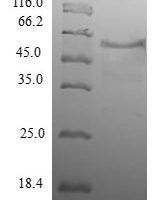 Human WD repeat-containing protein 38 (WDR38) Recombinant Protein - BioCrest Sci