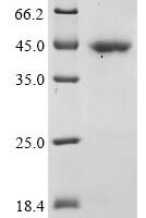 Chicken Heat shock 70 kDa protein, partial Recombinant Protein - BioCrest Sci
